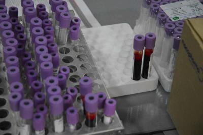 Akcija dobrovoljnog davanja krvi u Apatinu zakazana za utorak